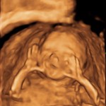 Week 19 Ultrasound